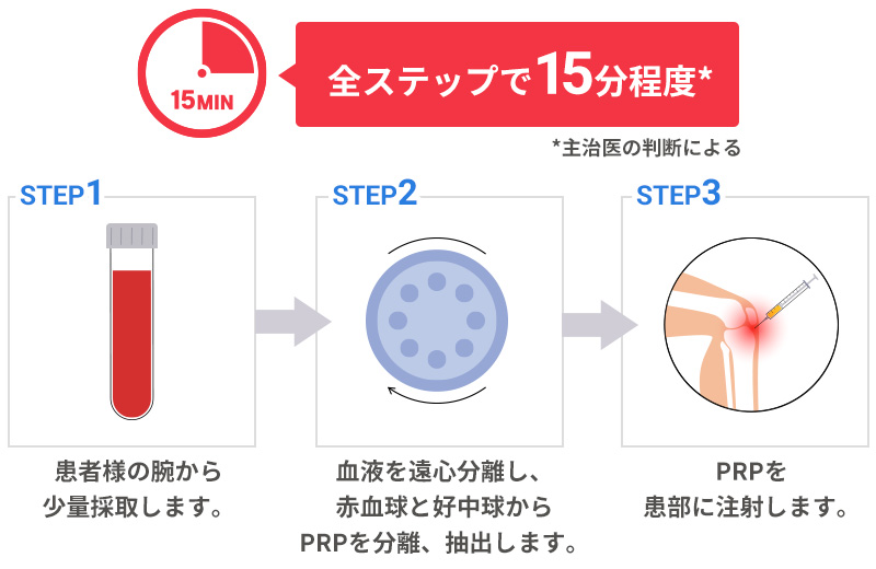 治療の流れ